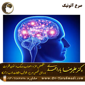 صرع آتونیک